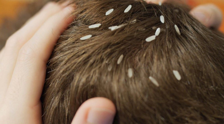 It looks like a pimple on his head, but what they pulled out shocked them