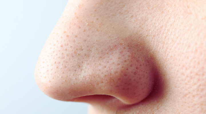 Your Nose: The First Indicator of Serious Health Concerns